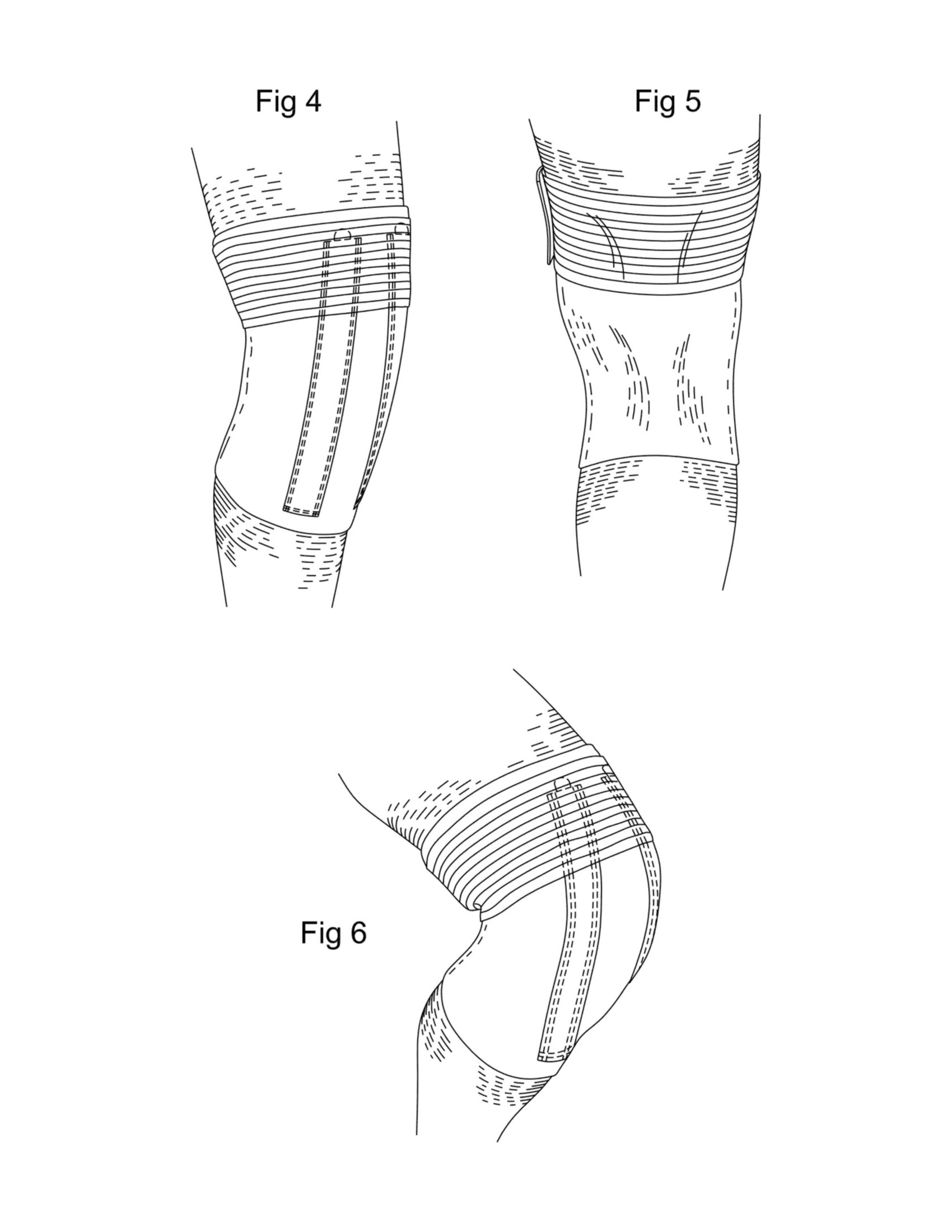kneebrace